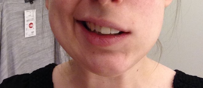 Dit was mijn breedste glimlach net na mijn laatste tandartsbezoek met dubbele dosis verdoving :')